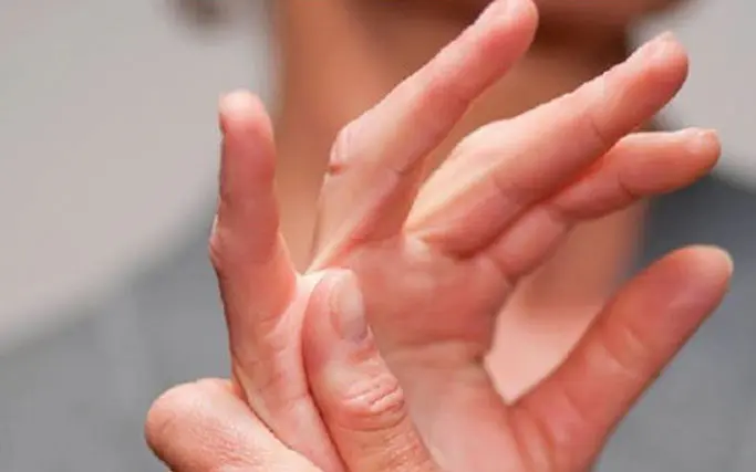 متلازمة الإصبع الزناد